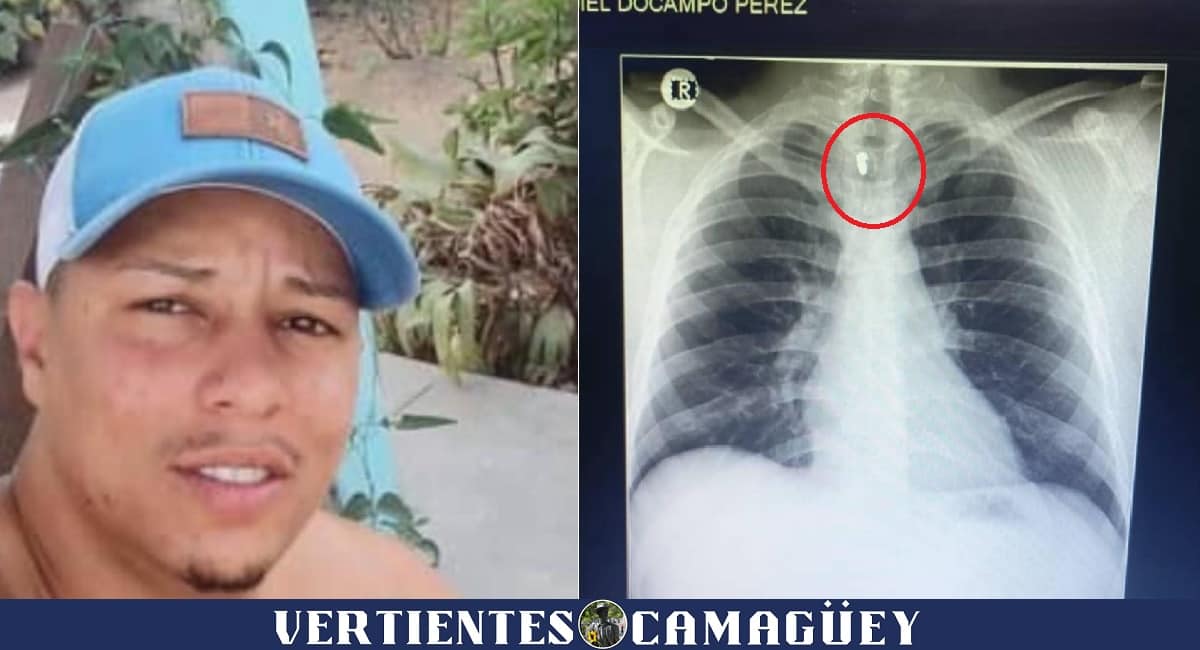 Vertientes
